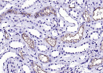 ACE2 Mouse Monoclonal Antibody