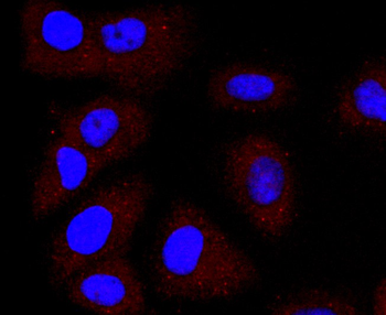 LYVE1 Recombinant Rabbit Monoclonal Antibody