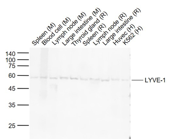 LYVE1 Recombinant Rabbit Monoclonal Antibody