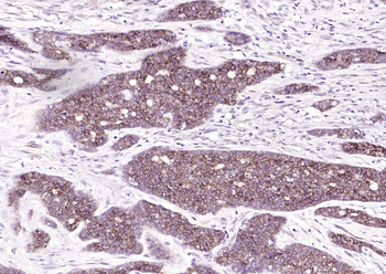 EpCAM Recombinant Rabbit Monoclonal Antibody