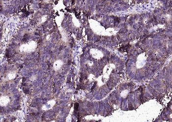 EpCAM Recombinant Rabbit Monoclonal Antibody