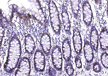EpCAM Recombinant Rabbit Monoclonal Antibody