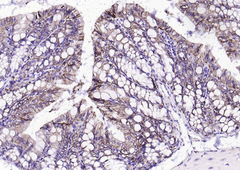 EpCAM Recombinant Rabbit Monoclonal Antibody