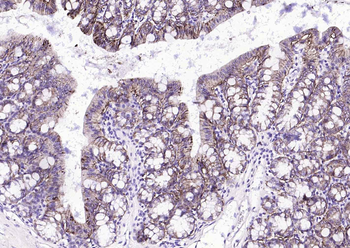 EpCAM Recombinant Rabbit Monoclonal Antibody
