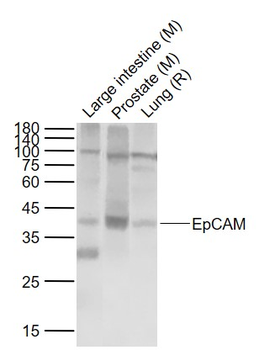 EpCAM Recombinant Rabbit Monoclonal Antibody