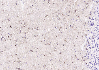 NMDAR1 Recombinant Rabbit Monoclonal Antibody