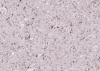 NMDAR1 Recombinant Rabbit Monoclonal Antibody