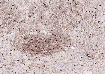NMDAR1 Recombinant Rabbit Monoclonal Antibody
