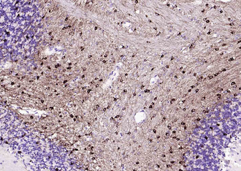 NMDAR1 Recombinant Rabbit Monoclonal Antibody