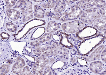 DRD1 Recombinant Rabbit Monoclonal Antibody