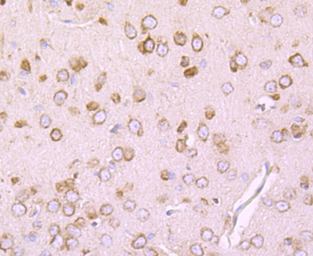 DRD1 Recombinant Rabbit Monoclonal Antibody
