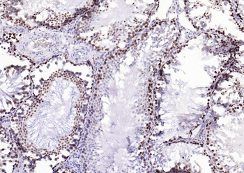 Bub3 Recombinant Rabbit Monoclonal Antibody