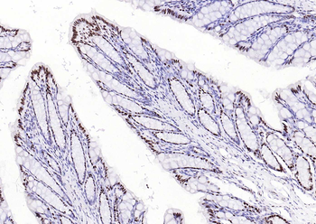 Bub3 Recombinant Rabbit Monoclonal Antibody