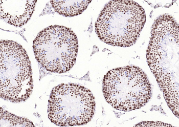 Bub3 Recombinant Rabbit Monoclonal Antibody