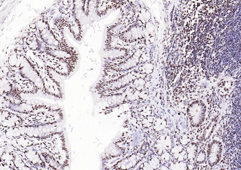 Bub3 Recombinant Rabbit Monoclonal Antibody