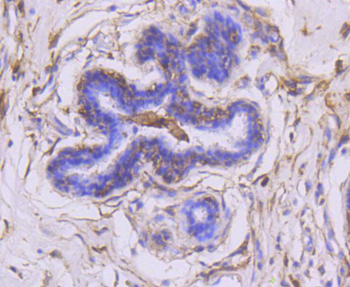 MMP14 Recombinant Rabbit Monoclonal Antibody