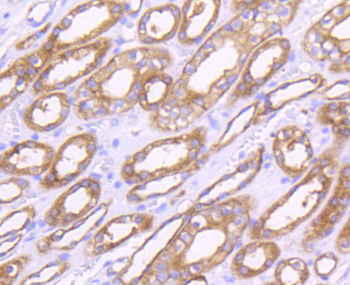 MMP14 Recombinant Rabbit Monoclonal Antibody
