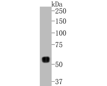 MMP14 Recombinant Rabbit Monoclonal Antibody