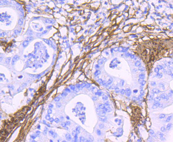 Alpha smooth muscle Actin Recombinant Rabbit Monoclonal Antibody