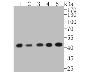 Alpha smooth muscle Actin Recombinant Rabbit Monoclonal Antibody