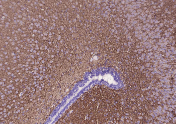 Synaptophysin Recombinant Rabbit Monoclonal Antibody