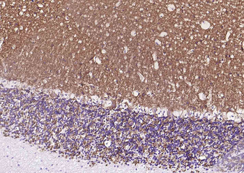 Synaptophysin Recombinant Rabbit Monoclonal Antibody