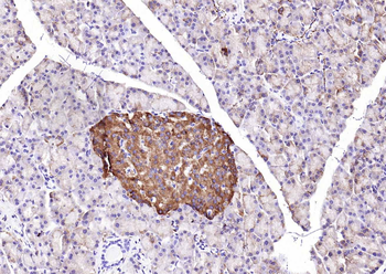 Synaptophysin Recombinant Rabbit Monoclonal Antibody
