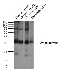 Synaptophysin Recombinant Rabbit Monoclonal Antibody