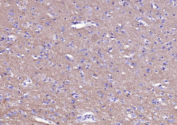 Synaptophysin Recombinant Rabbit Monoclonal Antibody