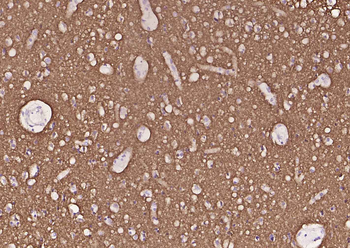 Synaptophysin Recombinant Rabbit Monoclonal Antibody