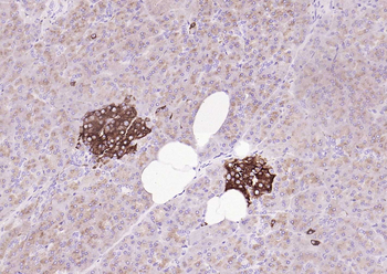 Synaptophysin Recombinant Rabbit Monoclonal Antibody