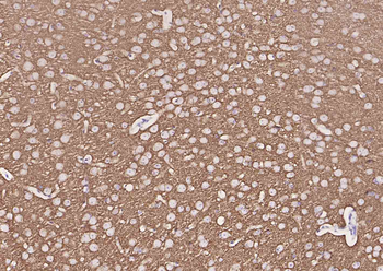 Synaptophysin Recombinant Rabbit Monoclonal Antibody