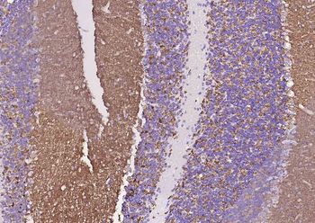 Synaptophysin Recombinant Rabbit Monoclonal Antibody