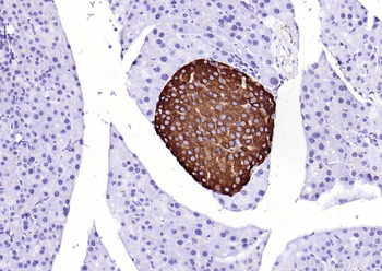 Synaptophysin Recombinant Rabbit Monoclonal Antibody