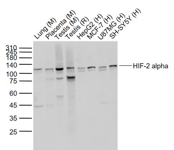 HIF-2 alpha Recombinant Rabbit Monoclonal Antibody