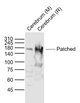 Patched Rabbit Polyclonal Antibody