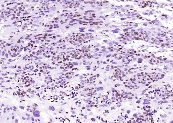 Survivin Recombinant Rabbit Monoclonal Antibody