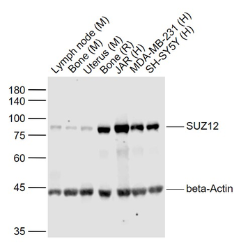 SUZ12 Recombinant Rabbit Monoclonal Antibody