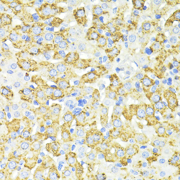 SQSTM1/p62 Rabbit Polyclonal Antibody