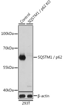 SQSTM1/p62 Rabbit Polyclonal Antibody
