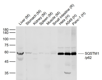 SQSTM1/p62 Rabbit Polyclonal Antibody