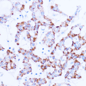 SIRT3 Rabbit Polyclonal Antibody