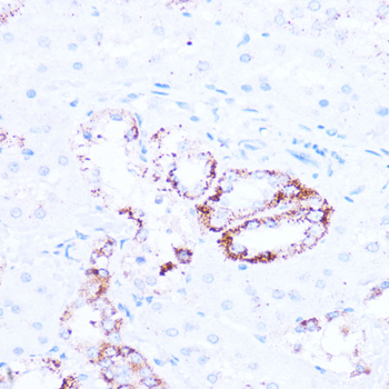 SIRT3 Rabbit Polyclonal Antibody