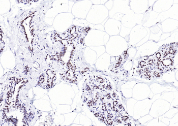 YY1 Recombinant Rabbit Monoclonal Antibody (Nuclear Loading Control)