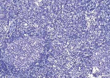 YY1 Recombinant Rabbit Monoclonal Antibody (Nuclear Loading Control)
