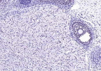 YY1 Recombinant Rabbit Monoclonal Antibody (Nuclear Loading Control)