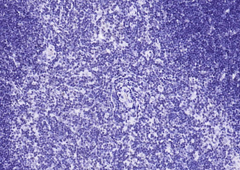 YY1 Recombinant Rabbit Monoclonal Antibody (Nuclear Loading Control)