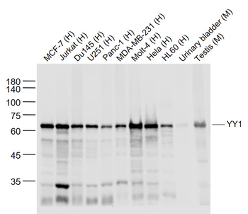 YY1 Recombinant Rabbit Monoclonal Antibody (Nuclear Loading Control)