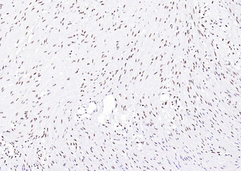 YY1 Recombinant Rabbit Monoclonal Antibody (Nuclear Loading Control)
