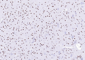 YY1 Recombinant Rabbit Monoclonal Antibody (Nuclear Loading Control)